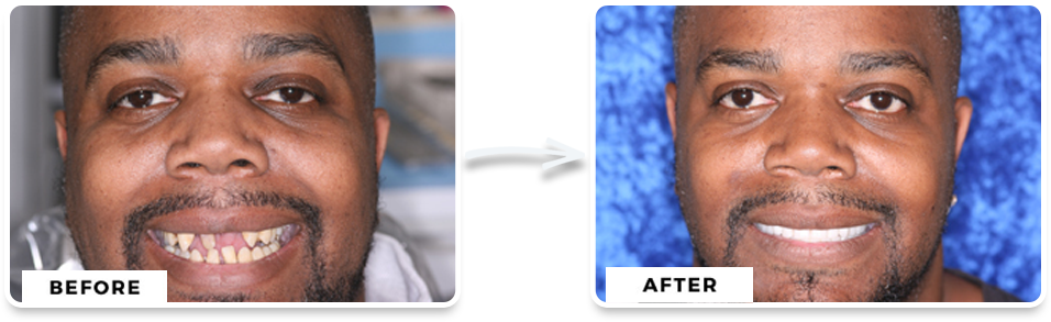 before and after